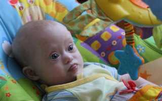 Symbol down syndrome символ синдрома