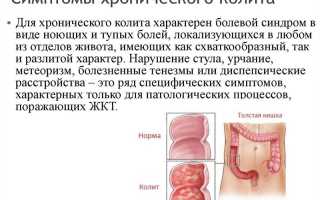 Спастический колит это синдром раздраженного кишечника