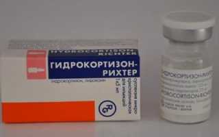 Лекарство при лечение туннельного синдрома