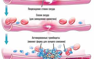 Геморрагический синдром профилактика и лечение