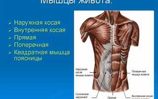 Птоз брюшной стенки код мкб