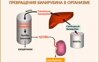 Препараты запрещенные при синдроме жильбера