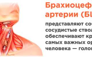 Стеноз сосудов шеи код мкб