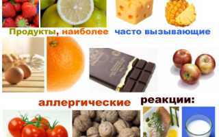 Пищевая аллергическая реакция код мкб