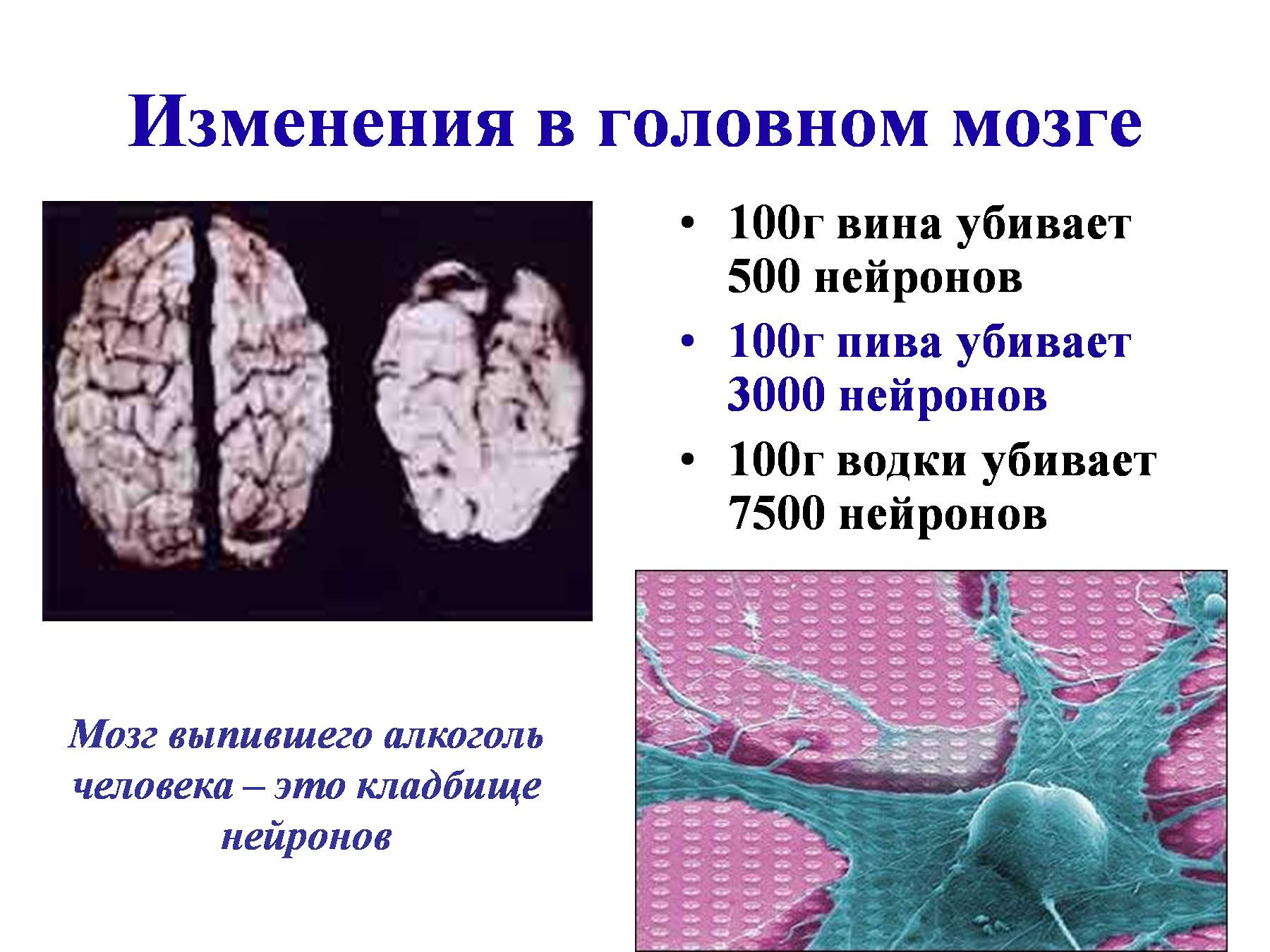Переизбыток мыслей в голове синдром