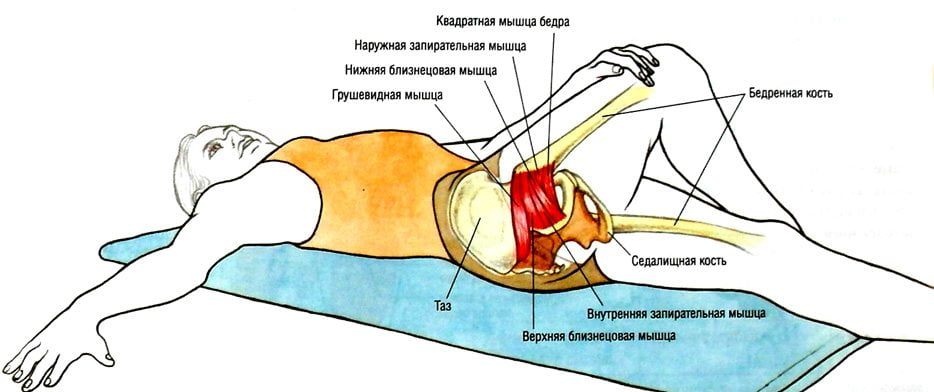 Лечение синдрома грушевидной мышцы народными средствами