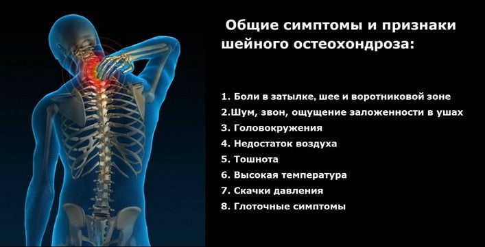 Остеохондроз корешковый синдром симптомы поясничного отдела