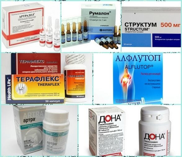 Корешковый синдром после удаления грыжи диска