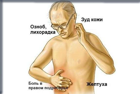 Синдром повышение билирубина в крови у