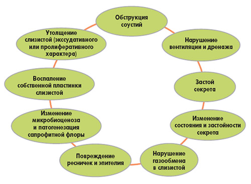 Риносинусит