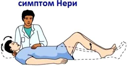 Остеохондроз корешковый синдром симптомы поясничного отдела