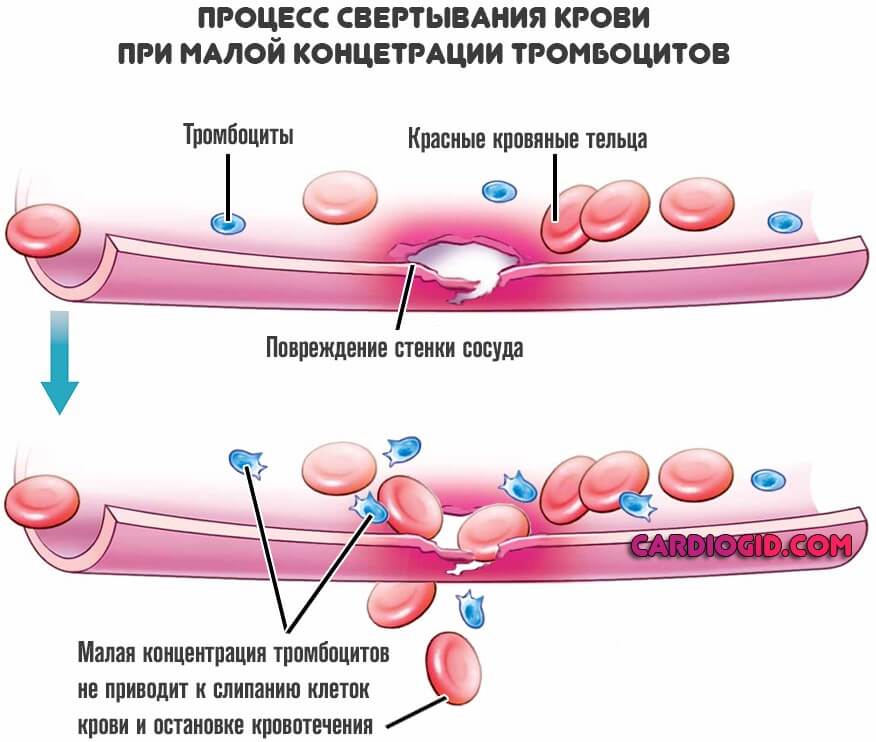 свертывание крови при недостатке тромбоцитов